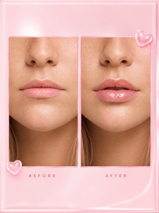 PlumpPro™ Lip Enhancer